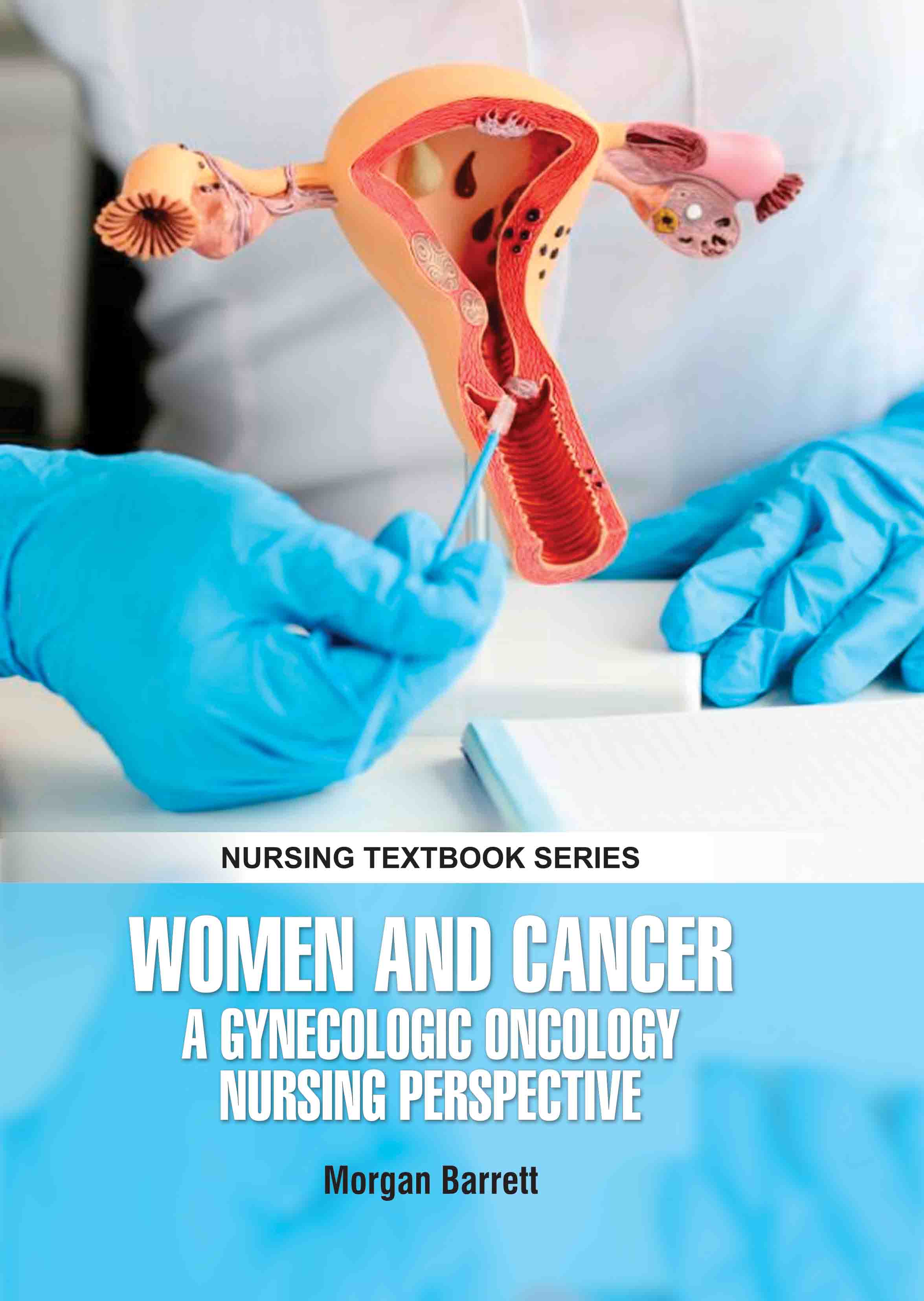 Women and Cancer: A Gynecologic Oncology Nursing Perspective 