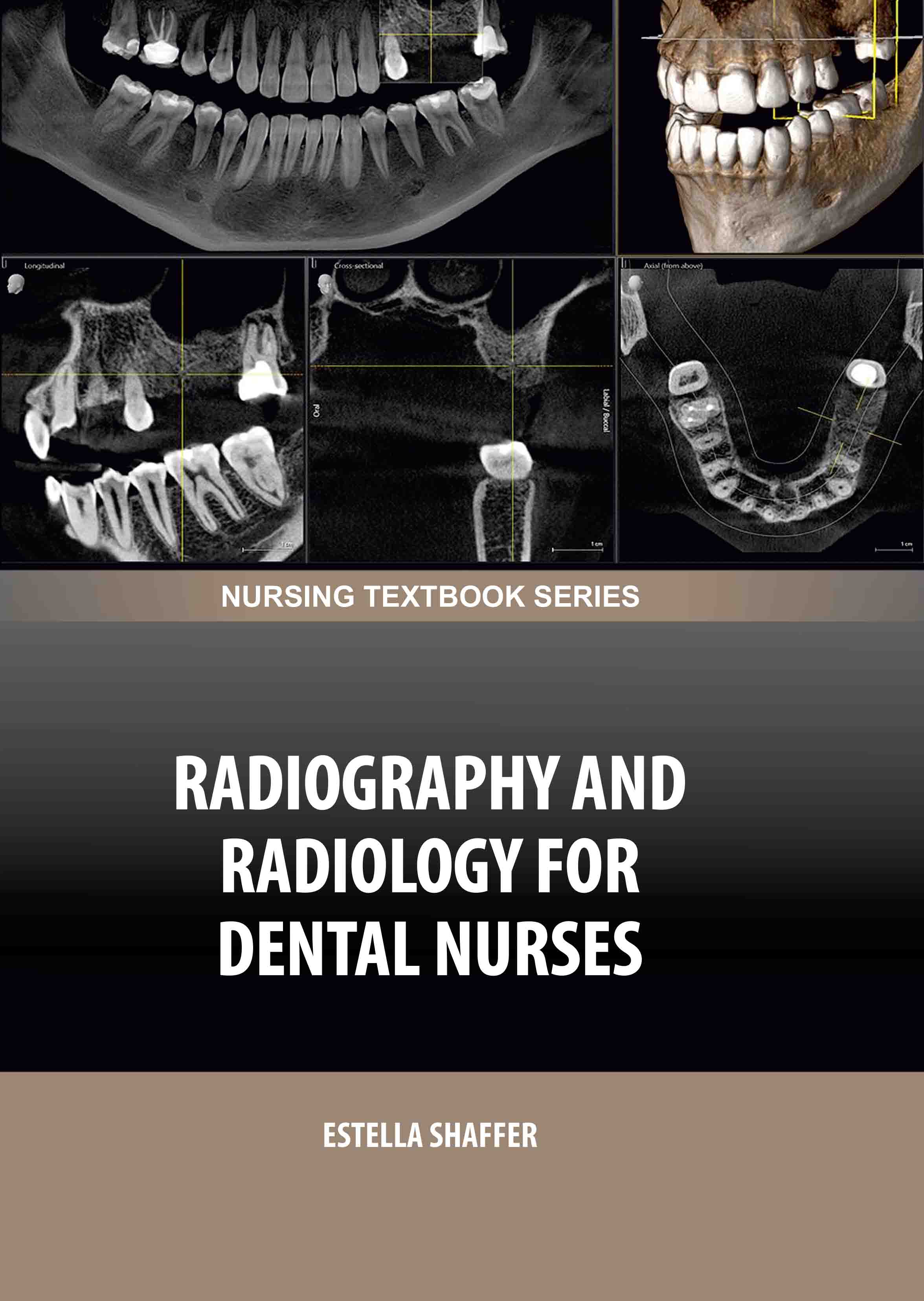 Radiography & Radiology for Dental Nurses 